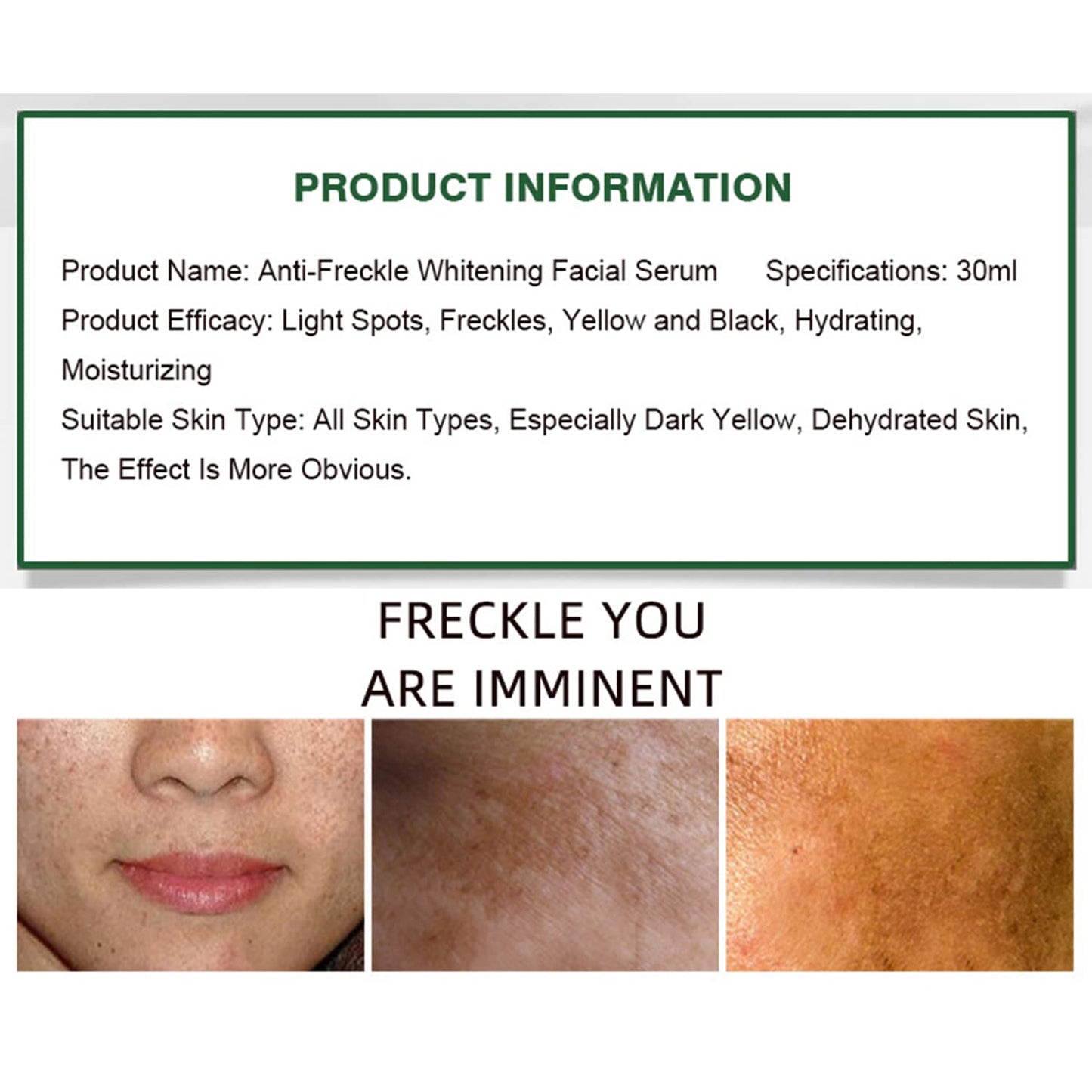 Aichun Beauty Anti-Freckle Serum 30ml