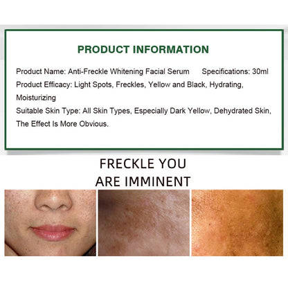 Aichun Beauty Anti-Freckle Serum 30ml