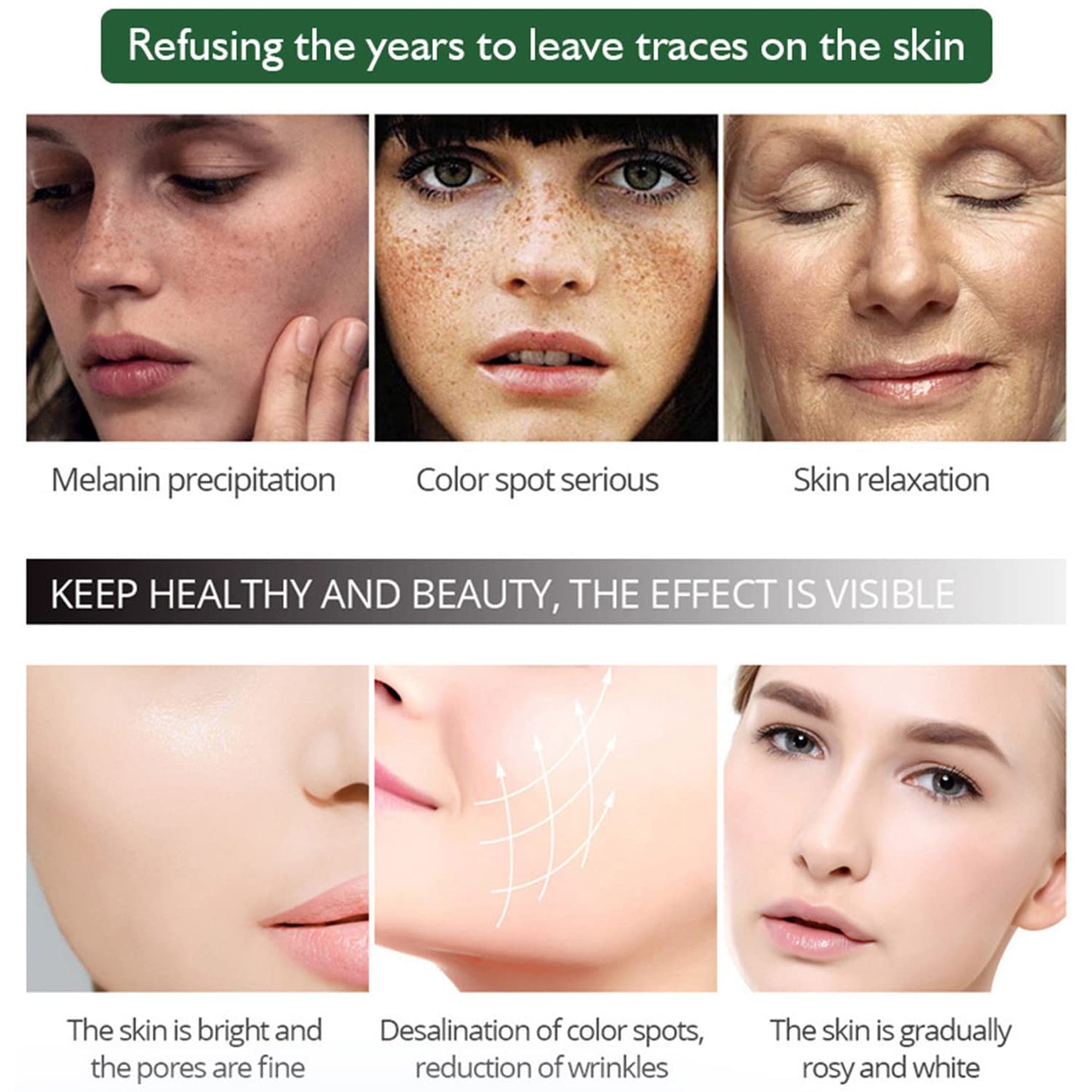 Aichun Beauty Anti-Freckle Serum 30ml