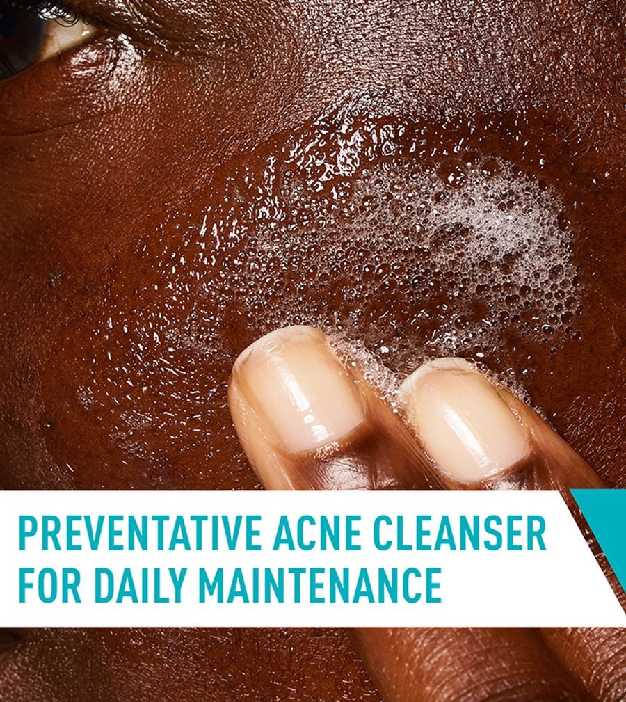 CeraVe Acne Control Cleanser 237ml