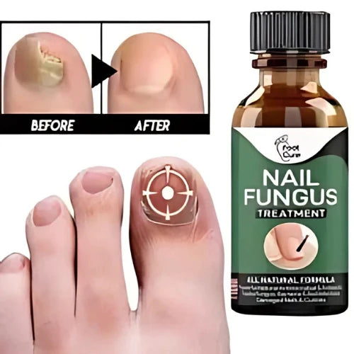 Nail Fungus Treatment Serum 10ml