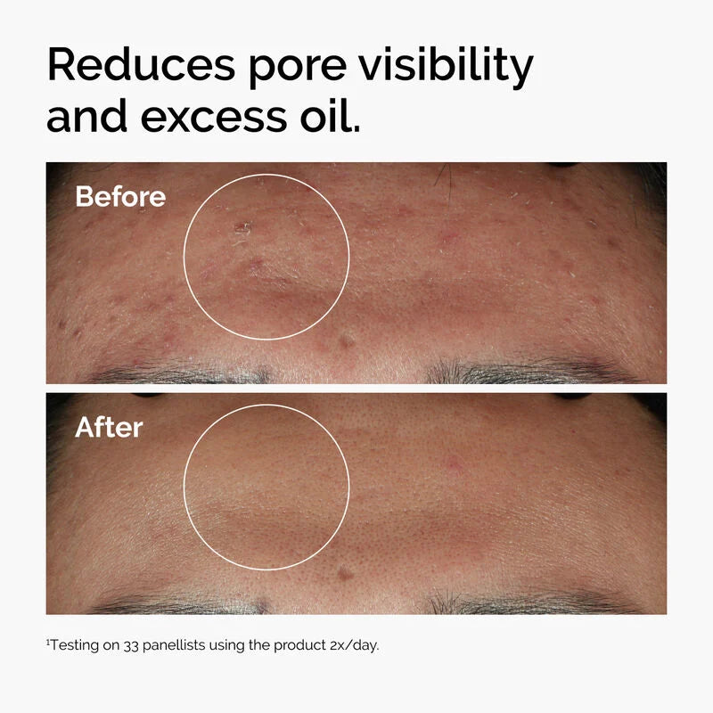 The Ordinary Niacinamide 10% + Zinc 1 %