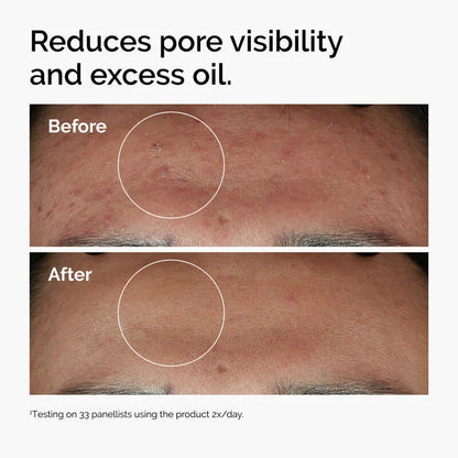 The Ordinary Niacinamide 10% + Zinc 1 %